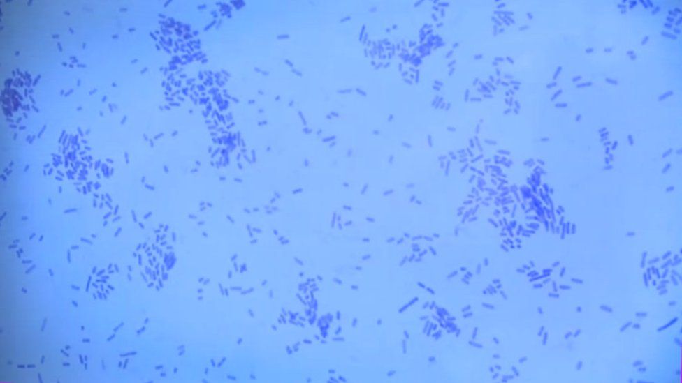 Microscope image of swabbed bacteria