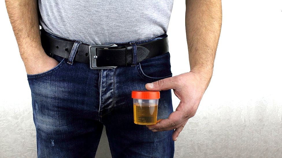 Man holding a urine sample
