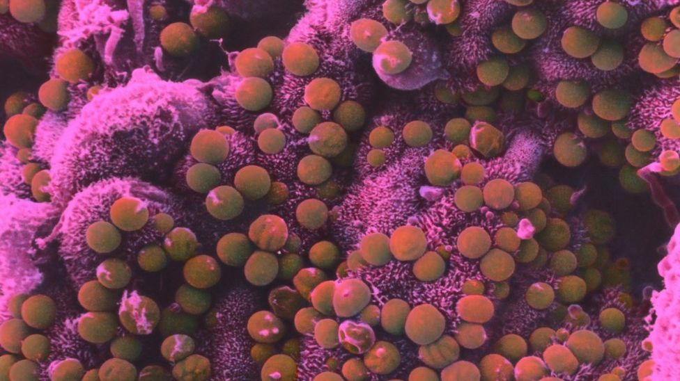 Clevedon water parasite boil notice lifted BBC News