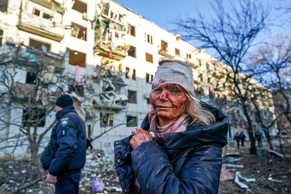 A wounded woman is seen after an airstrike damaged an apartment complex in city of Chuhuiv, Kharkiv Oblast, Ukraine, following the full-scale assault on Ukraine from Russia on 24 February 2022
