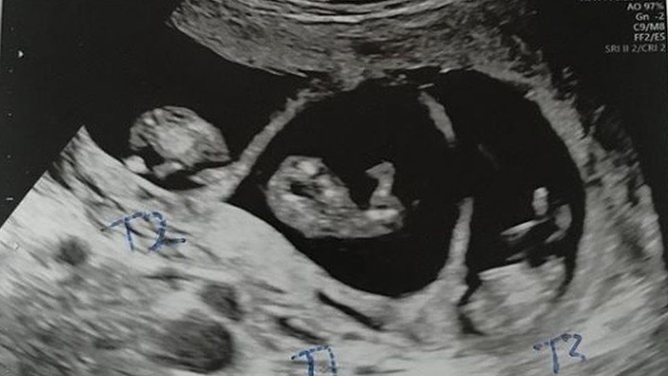 Shannon Steele's scan