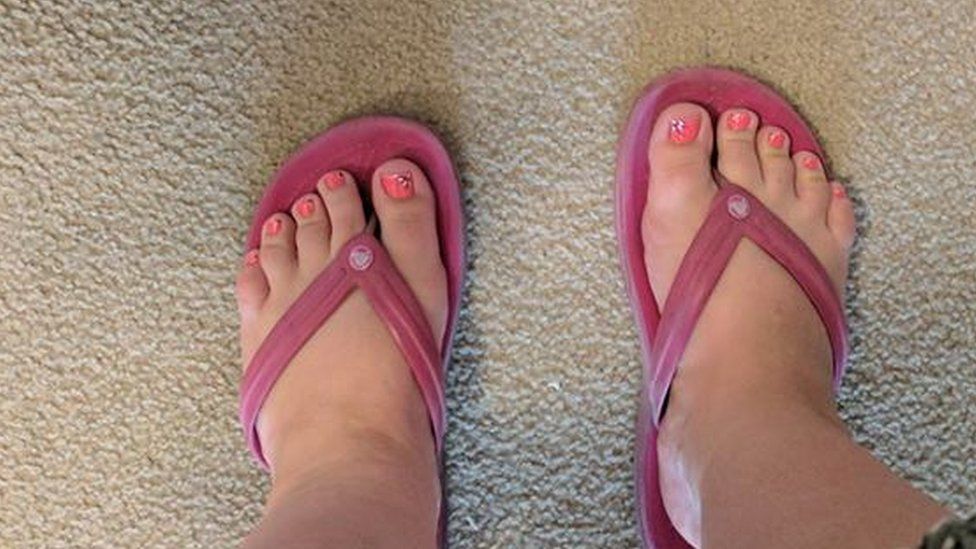 Canadian Woman Denied Pedicure Over Size Bbc News