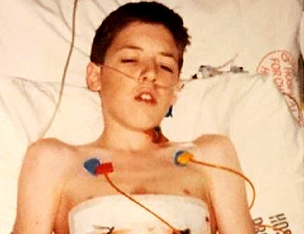 Robbie Black after his heart and lung transplant