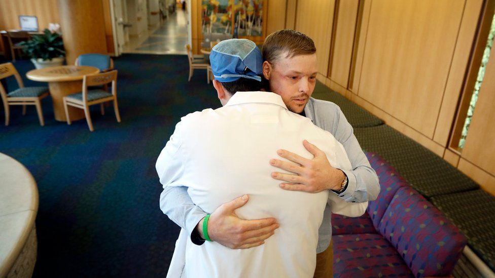 In this Jan. 25, 2017, photo, face transplant recipient Andy Sandness is hugged by Dr. Samir Mardini, who performed his surgery. You can see light scarring under his eyes and across his temples.