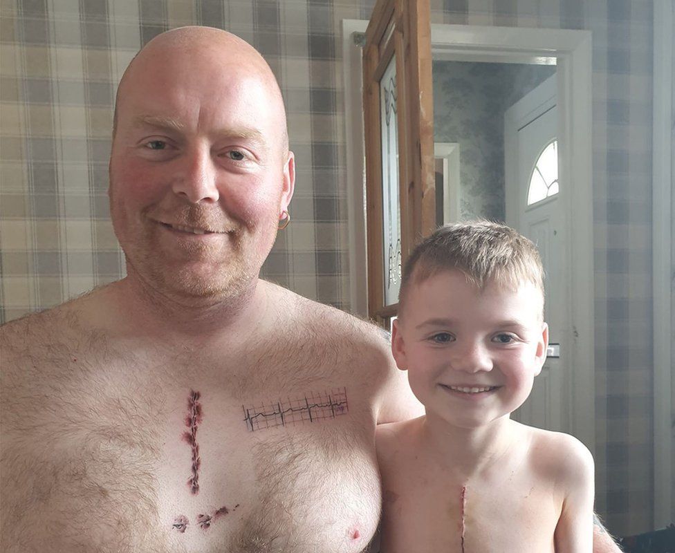 East Yorkshire father gets surgery scar tattoo to support son - BBC News