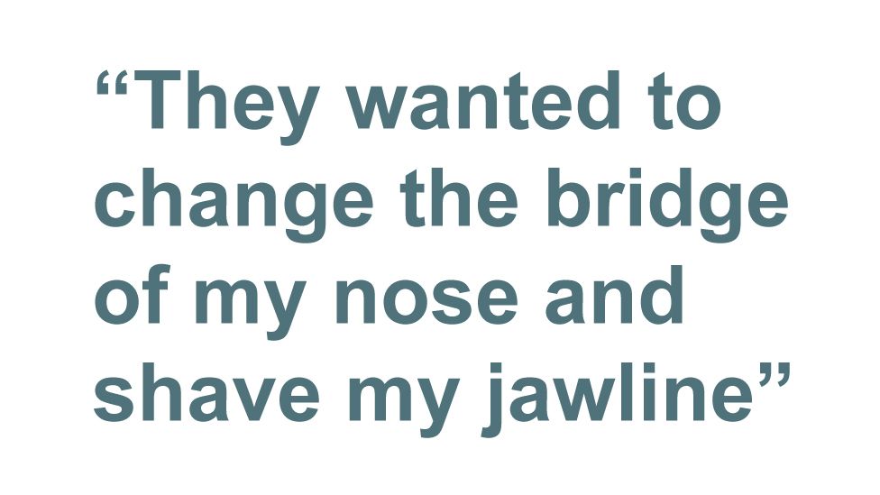 Quotebox: they wanted to change the bridge of my nose and shave my jawline