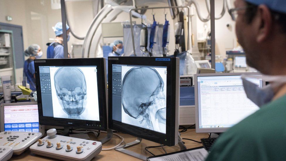 A doctor surveys an X-ray in a hospital ward.