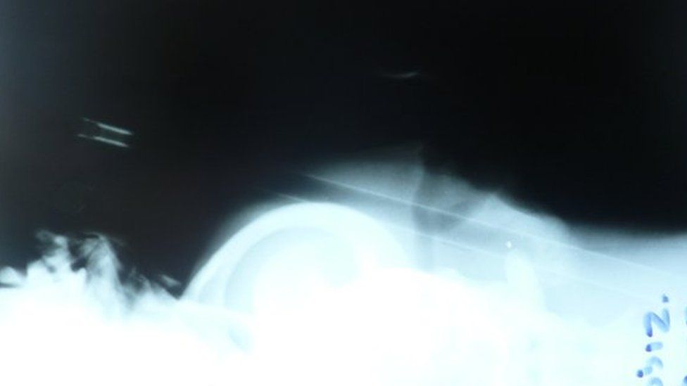 X-ray of crossbow through dog's skull