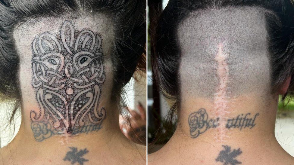 Before and after of head tattoo