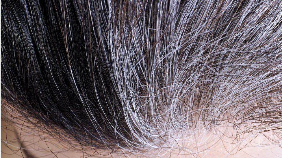 Grey roots in black hair