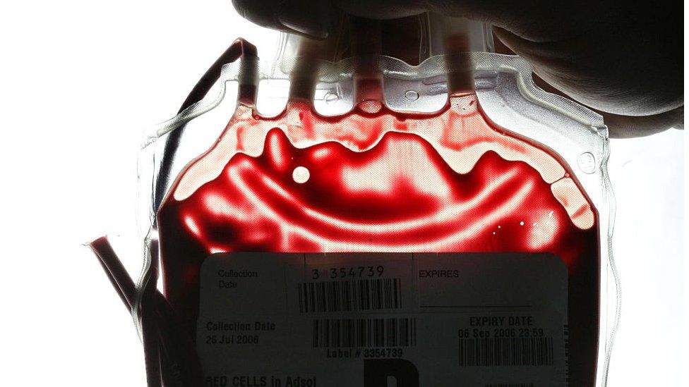 Bag of donated blood being held