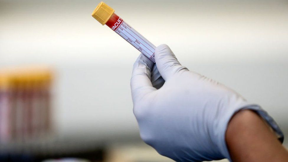 A paramedic holds a test tube containing a blood sample in one of the tubes.