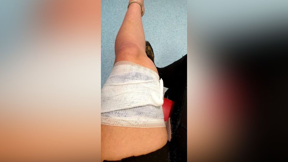 Surfer's thigh impaled by surfboard fin in Cornwall BBC News
