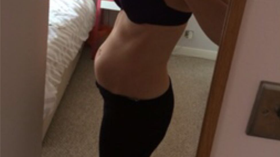 Laura Everley's bloated stomach