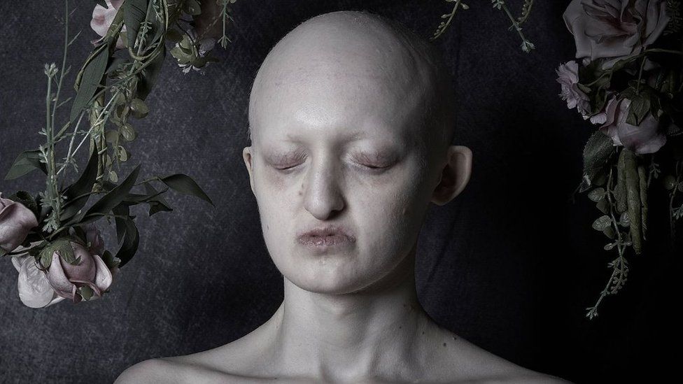 A woman with no hair appears as if to be asleep surrounded by flowers