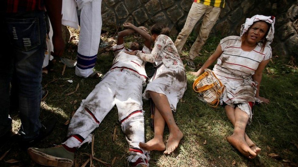 Injured protesters in Bishoftu town, Oromia region, Ethiopia, October 2