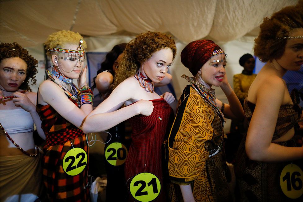 Participants are seen backstage at Mr and Miss Albinism beauty pageant