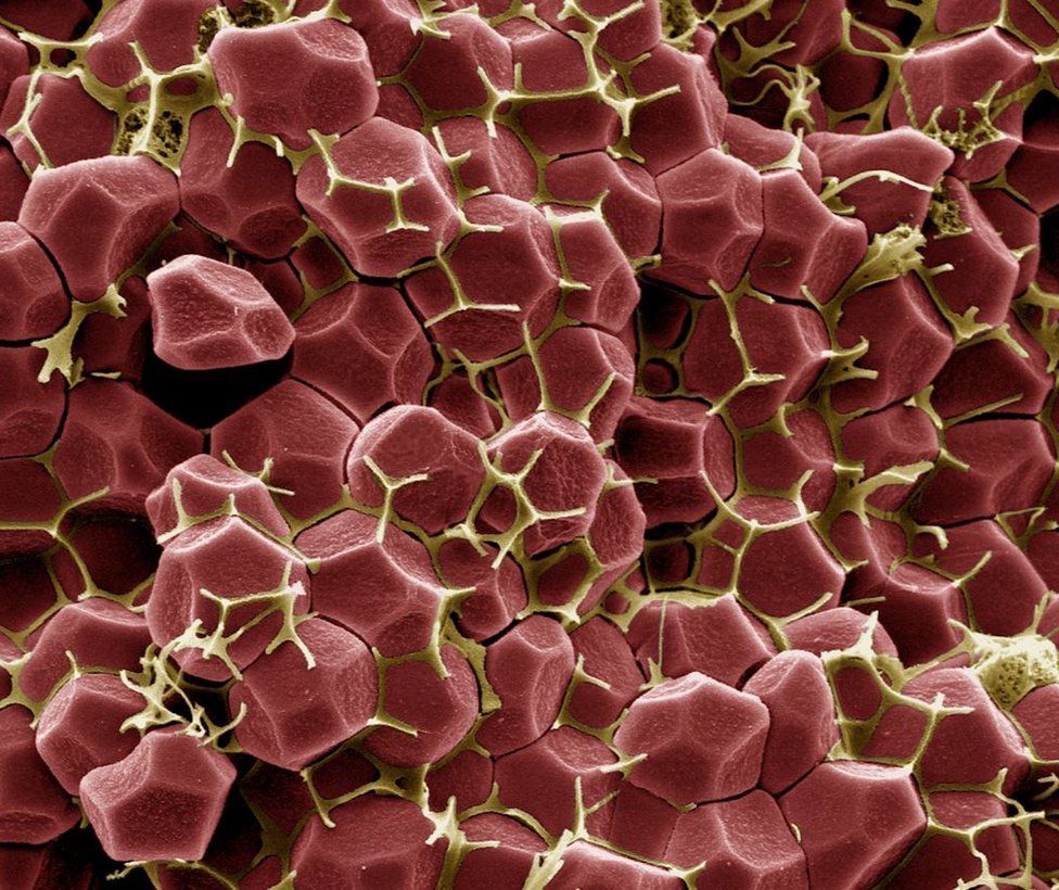 An image showing the internal structure of a blood clot