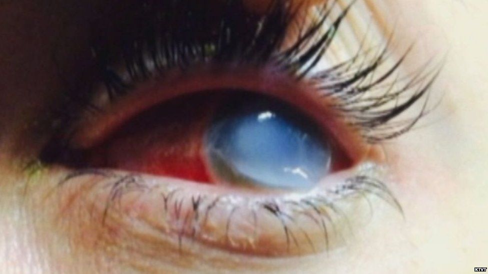 Close up of the eye