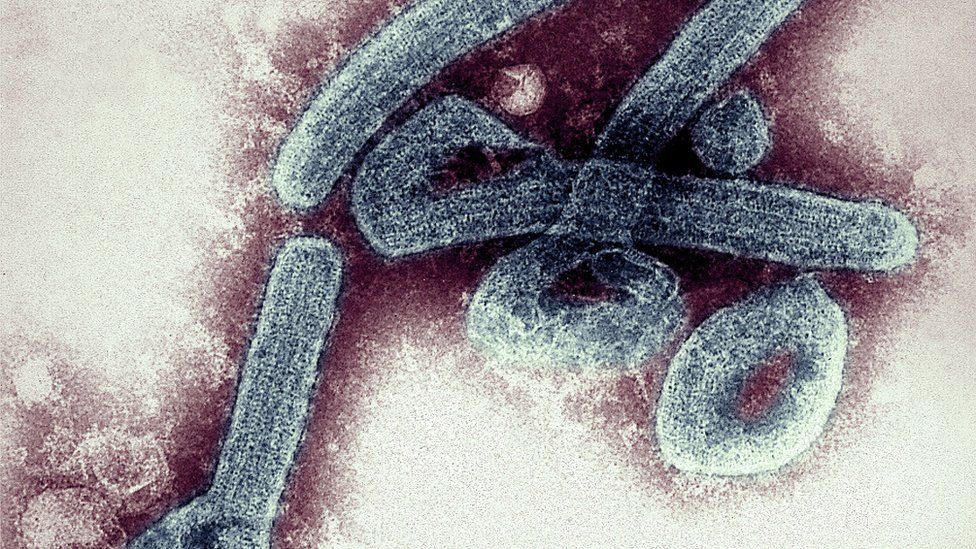 Marburg virus: Scientists to start human testing of vaccine - BBC News