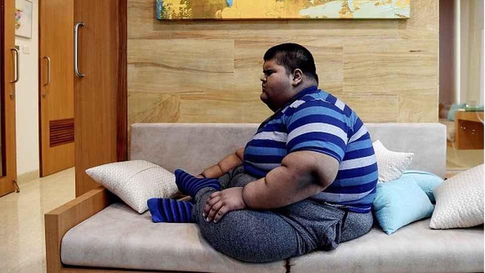 obesity in indian children