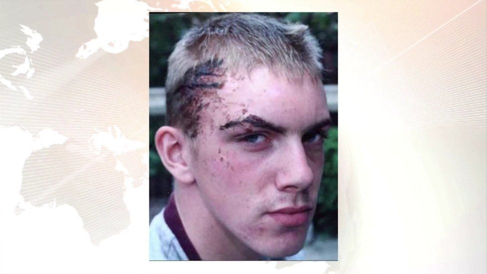 Ciarán Maxwell after he was assaulted as a 16-year-old boy