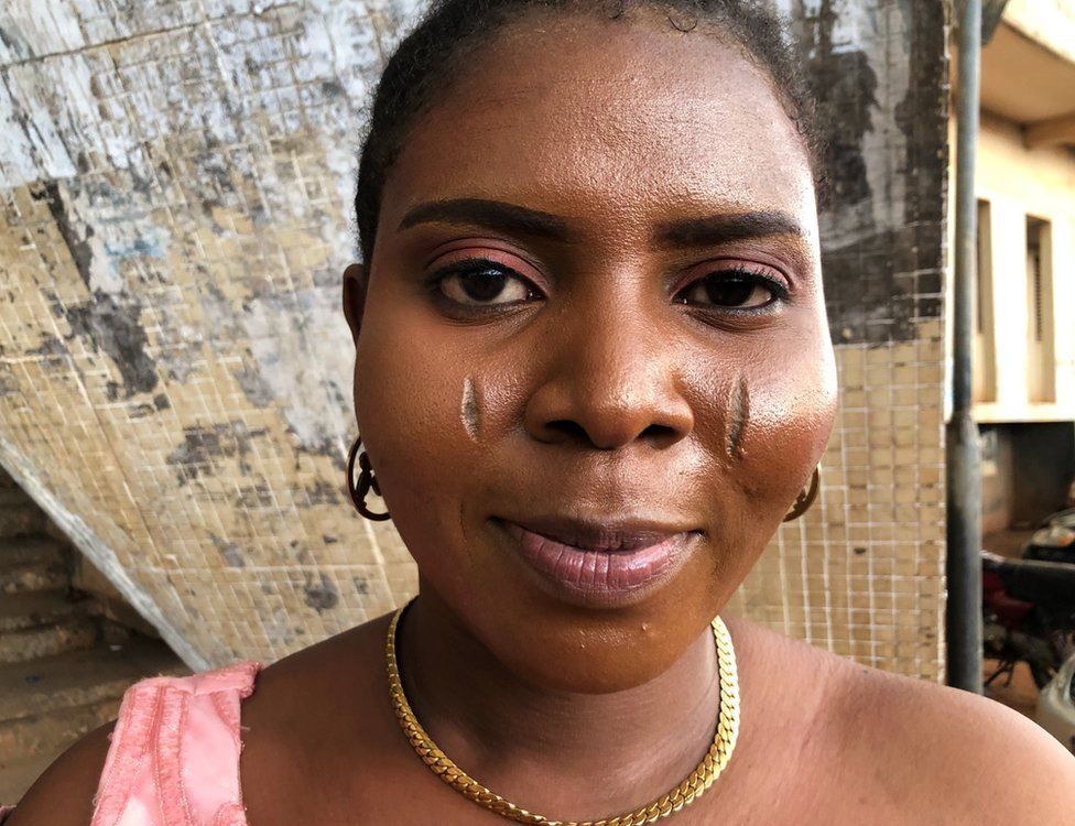 A woman with scars on her face
