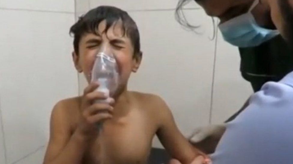 A boy breathing with an oxygen mask inside a hospital, after a suspected chlorine gas attack in Syria (07 September 2016)