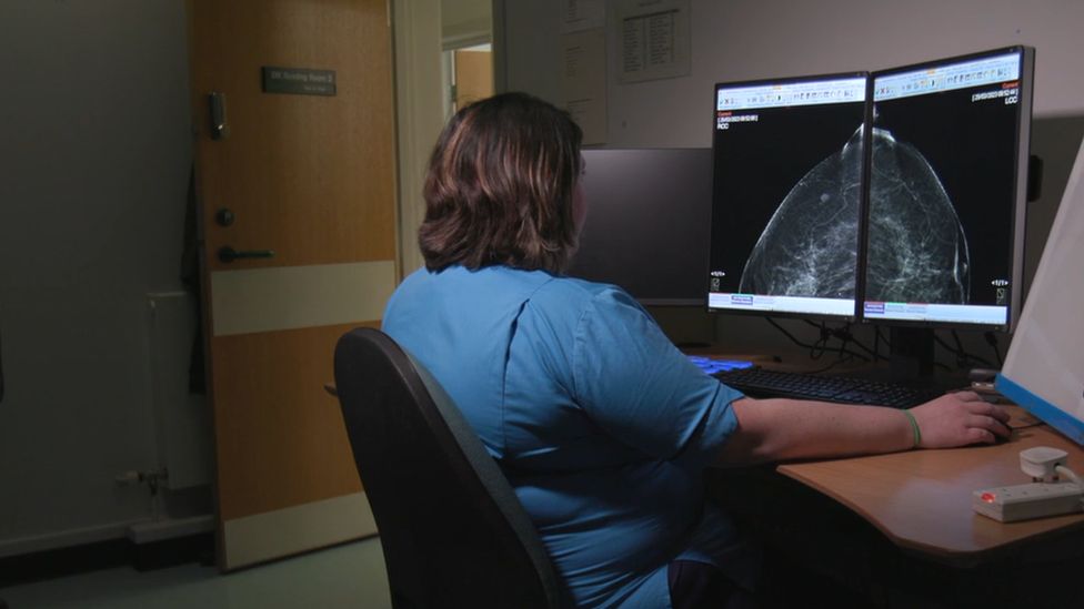 A radiologist reviews mammograms at Aberdeen Royal Infirmary