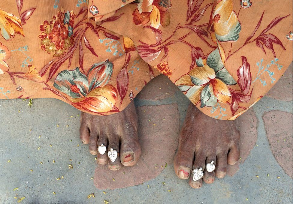Bhanwari Devi's feet