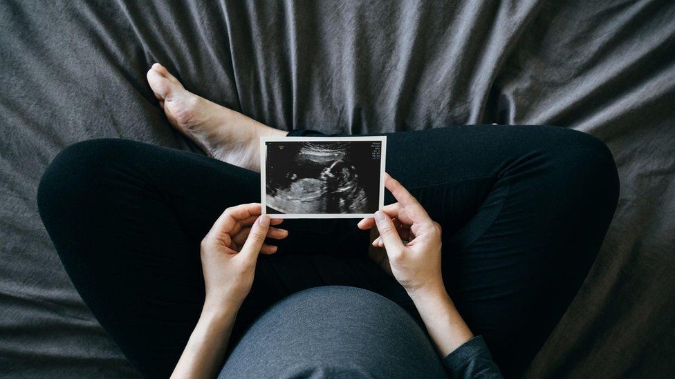 pregnant woman looking at scan photo