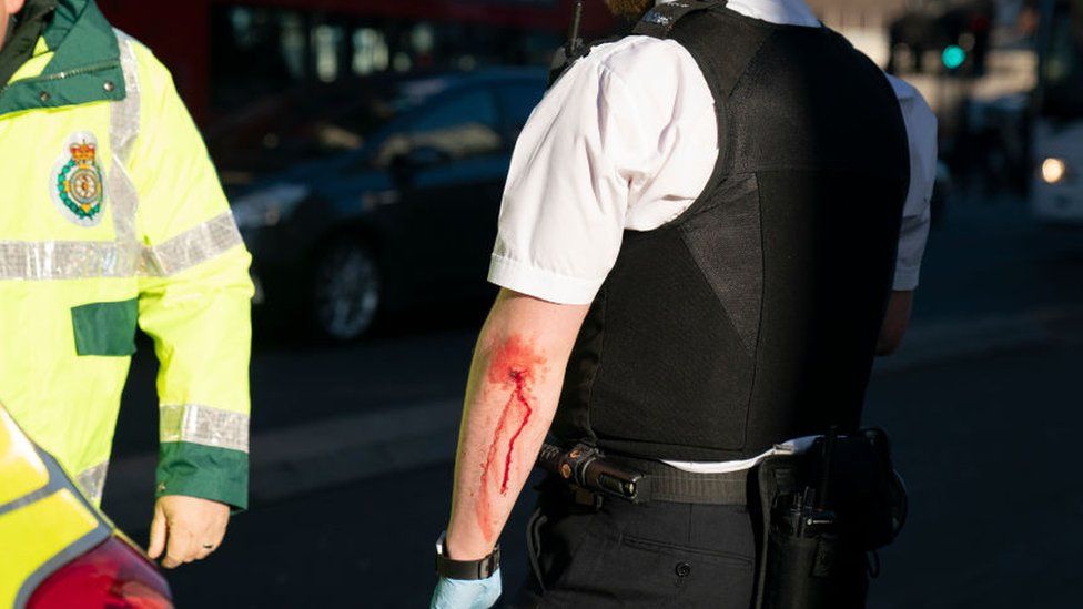 Police officer is treated by medic