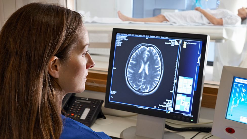 Стоковая фотография рентгенолога, смотрящего на изображение сканирования мозга на экране компьютера