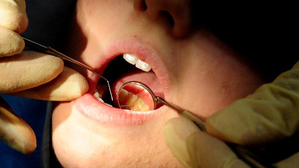 A dentist uses tools to look inside a patient's mouth