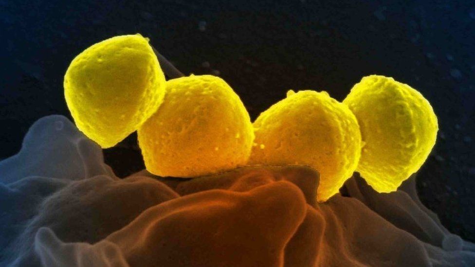 Scanning electron micrograph of Group A Streptococcus (Streptococcus pyogenes) bacteria on primary human neutrophil
