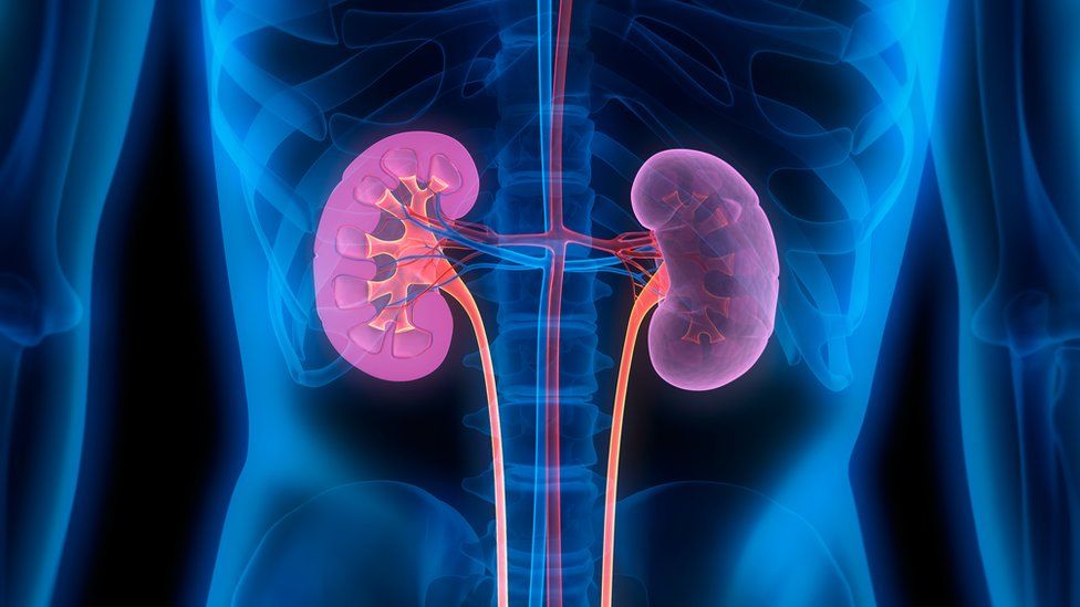 An artistic rendering of an x-ray showing two kidneys