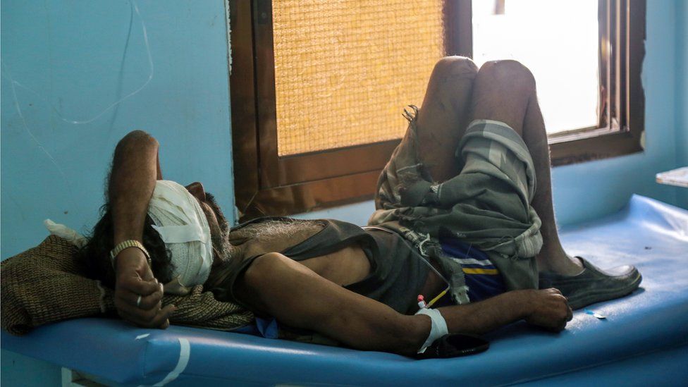 A Yemeni man lies in a hospital bed after he was reportedly injured in a Saudi-led coalition air strike against Shiite Huthi rebels and their allies on December 29, 2015