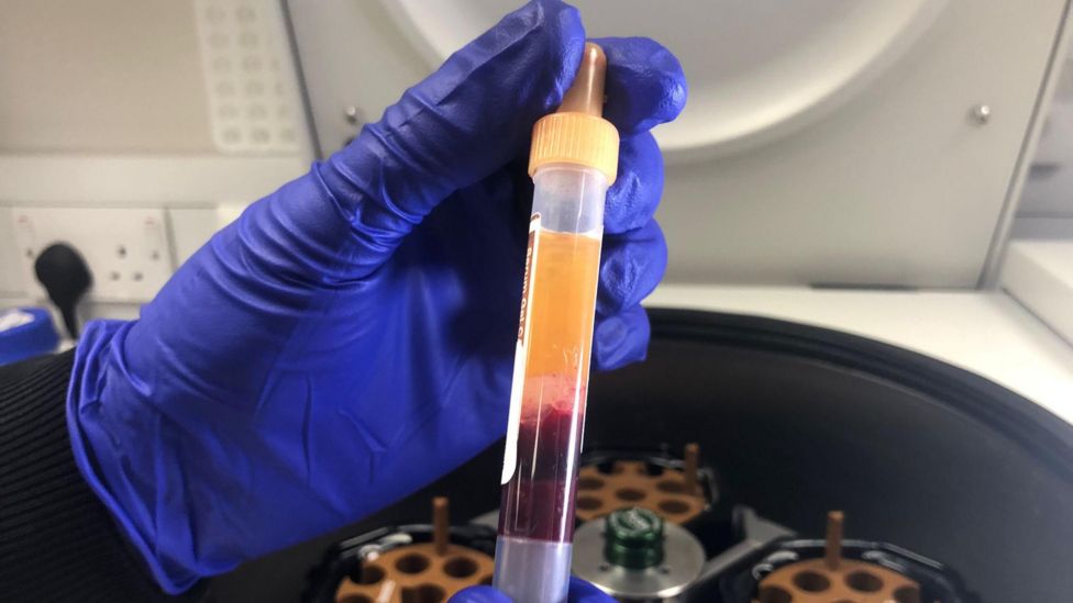 Covid 19 Cambridge Experts Using Volunteers For Vaccine Research Bbc