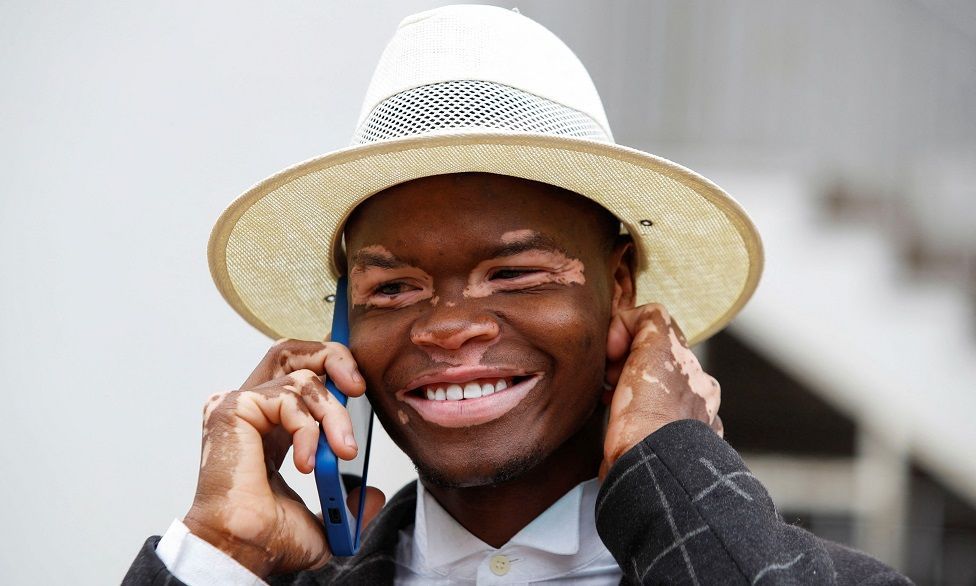 A smiling man wearing a sun hat speaks on the phone. He has the skin condition vitiligo.