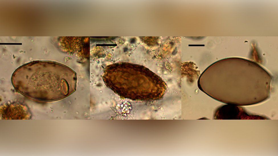 Slide showing microscopic worm eggs dating to the Bronze Age