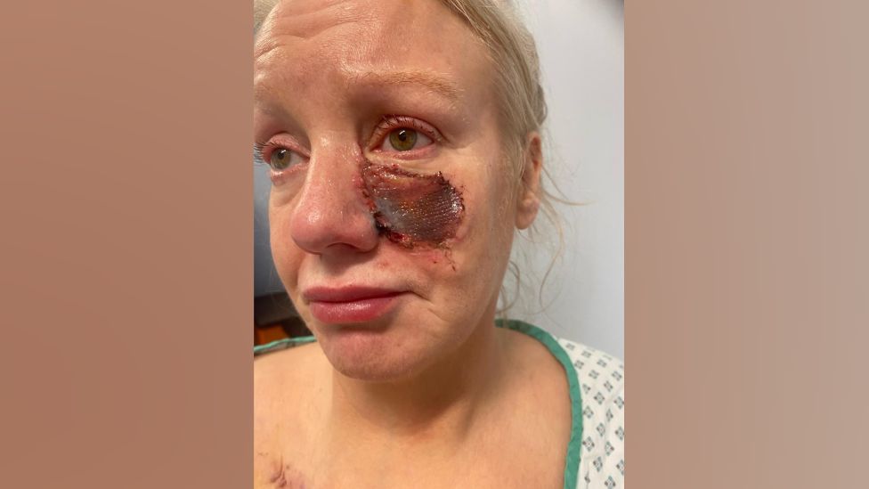 Kelly Allen with an open wound to her face