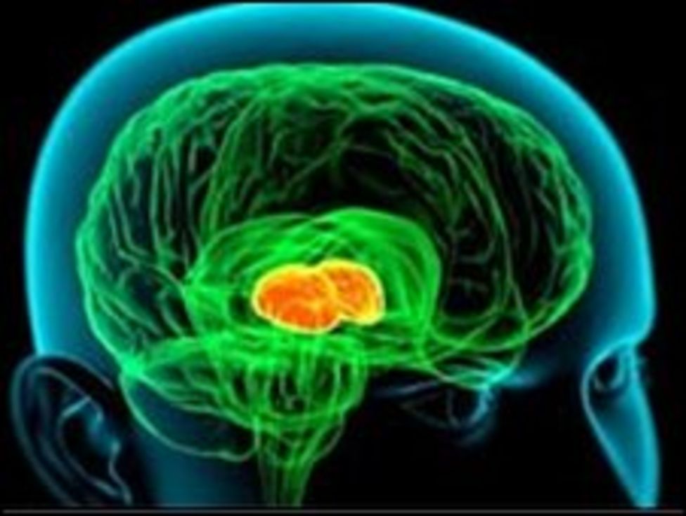 Creative Minds mimic Schizophrenia BBC News