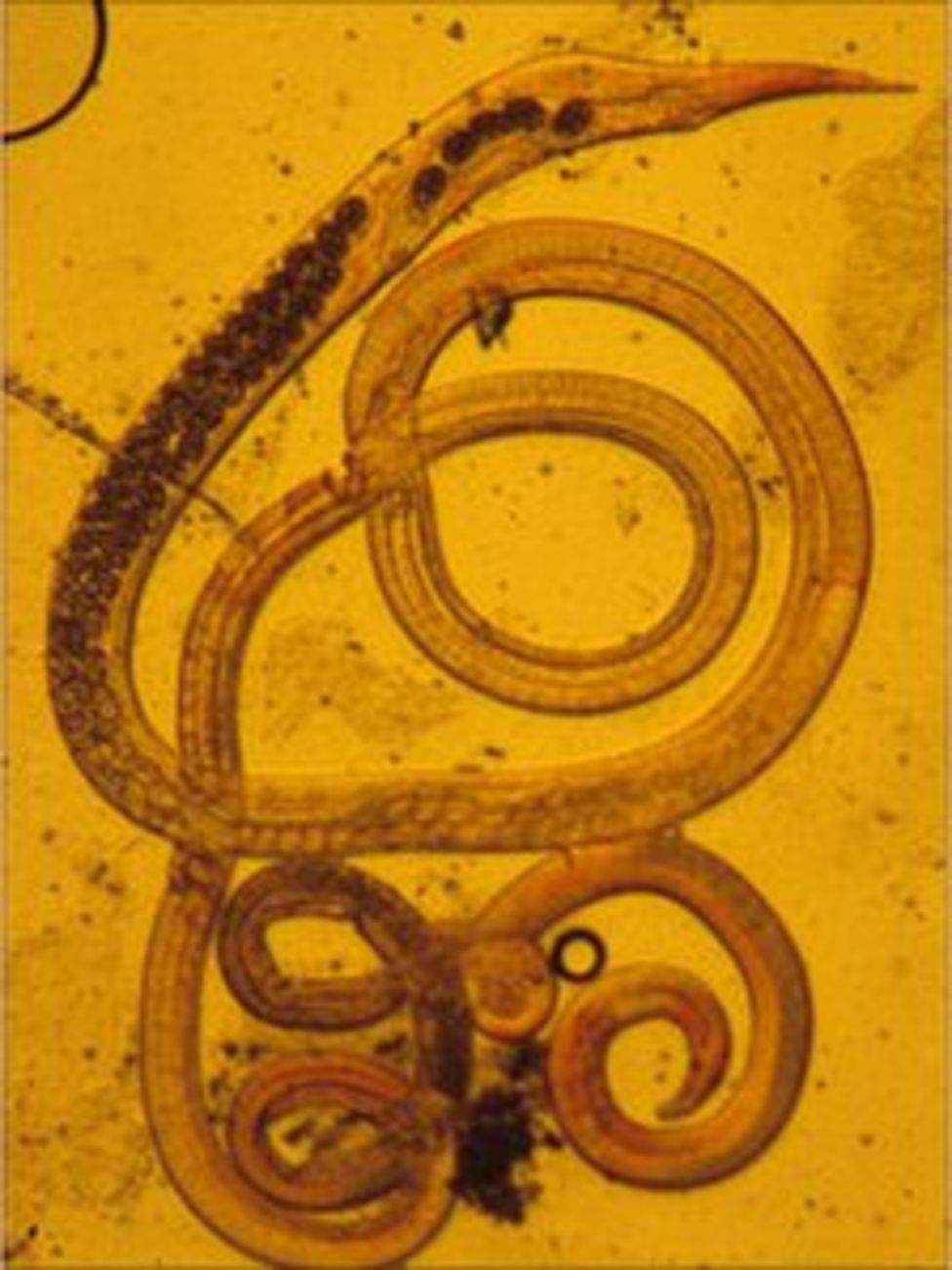 Parasite pioneer's worm naming reward BBC News