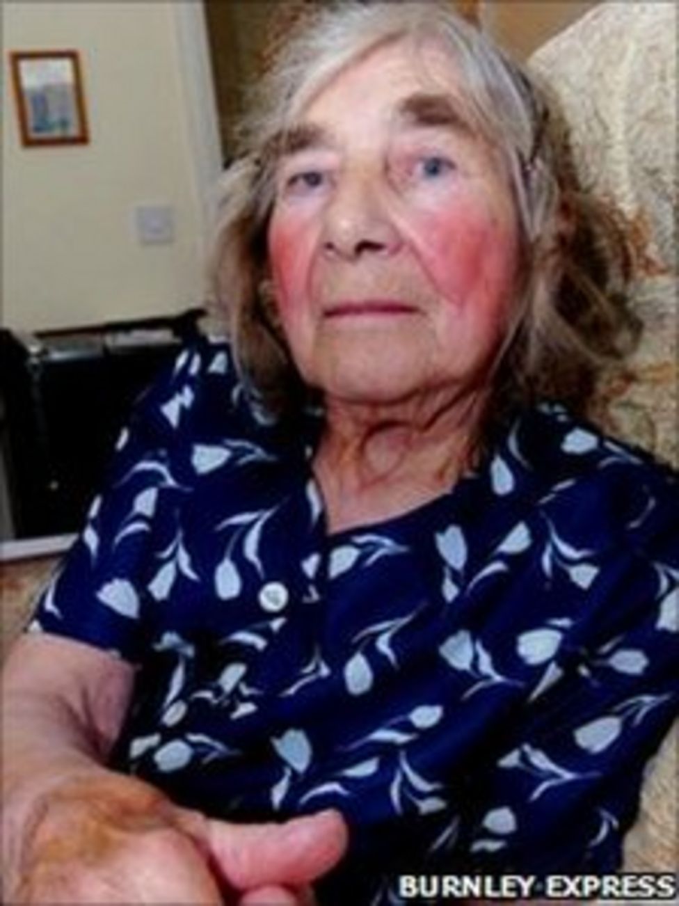 Burnley Woman 84 Dies After Three Muggings Bbc News