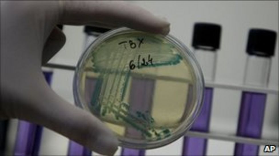 FSA revises guidance after E. coli outbreak BBC News