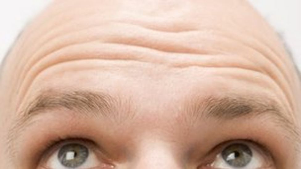 Clue To Male Baldness Discovered Bbc News