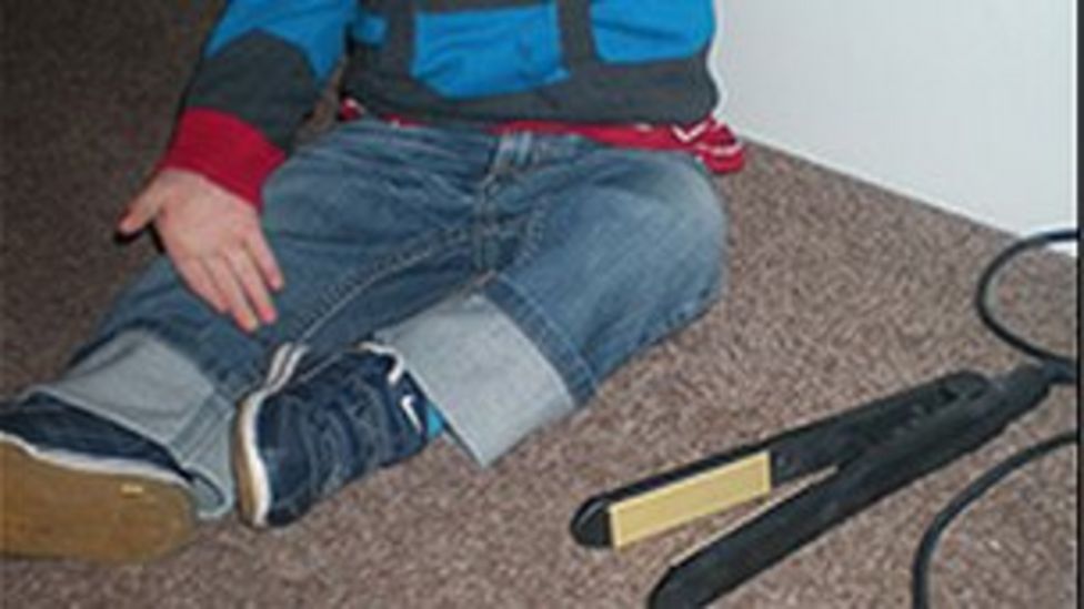 Hair straighteners Belfast hospital warns of children's injuries BBC