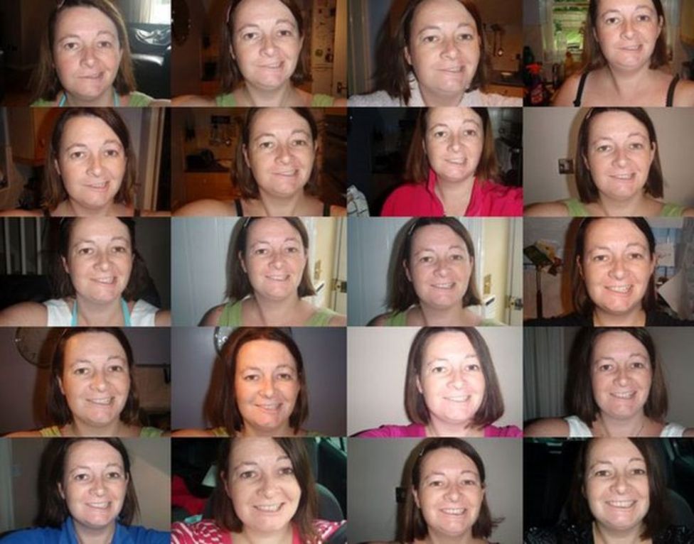 Bell's palsy Your stories of living with half a smile BBC News