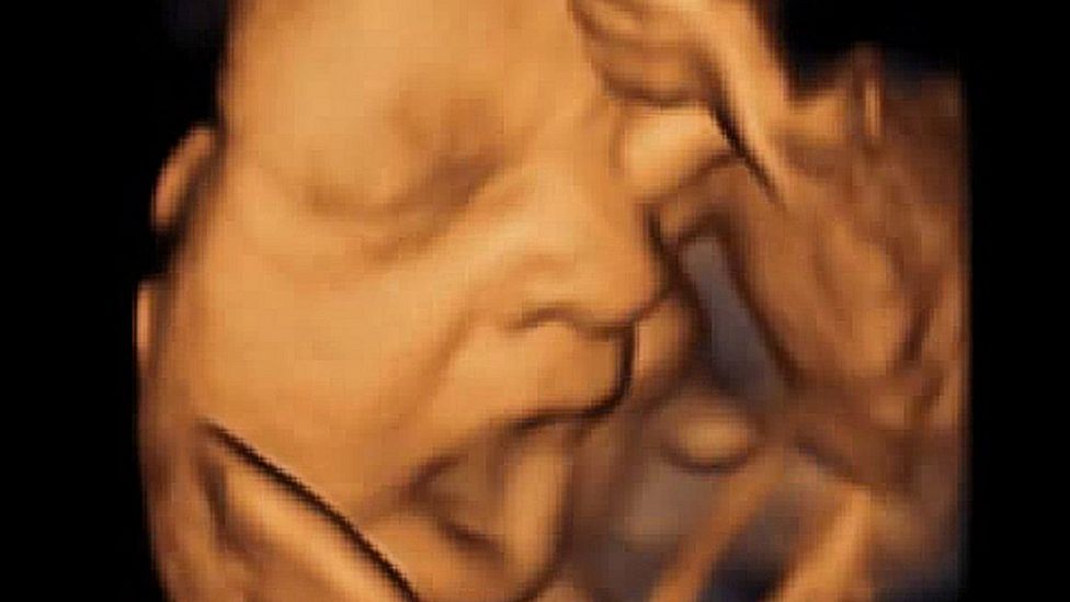 What happens in the brain to make us 'catch' yawns BBC News