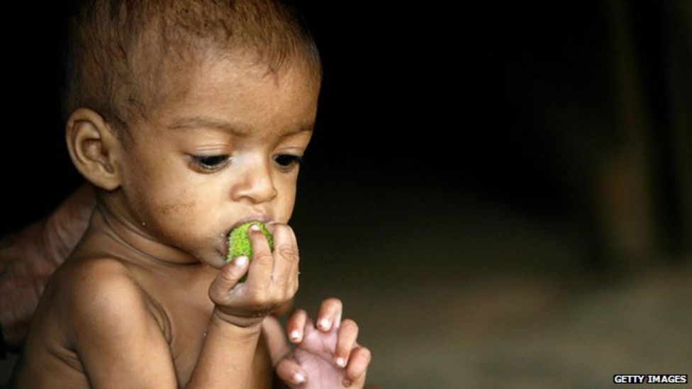 Viewpoint: Let's make malnutrition visible - BBC News